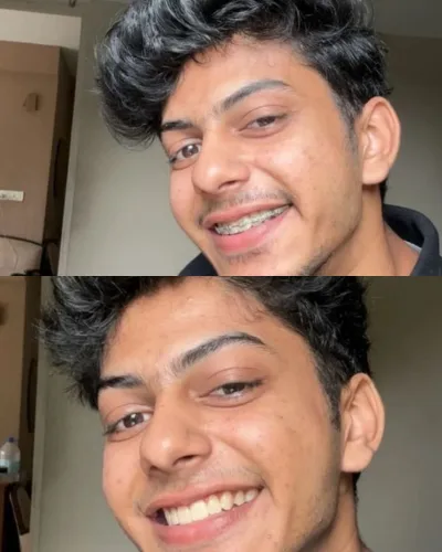 Smiling man showing the results of cosmetic dental treatment.