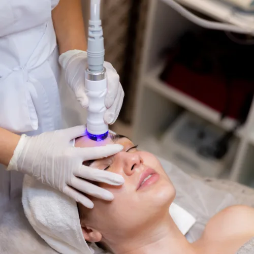 MNRF Treatment for Scars & Acne in Kochi | Novocare Clinic