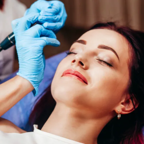Thread Lift Treatment Kochi