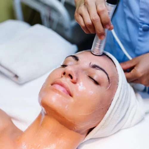 Carbon Laser Peel Treatment Kochi | Novocare Clinic