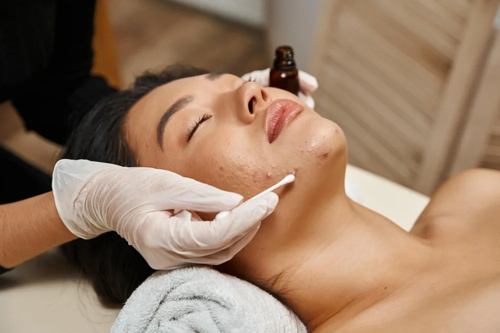 Acne & Scar Treatment Kochi | Clear Skin Solutions