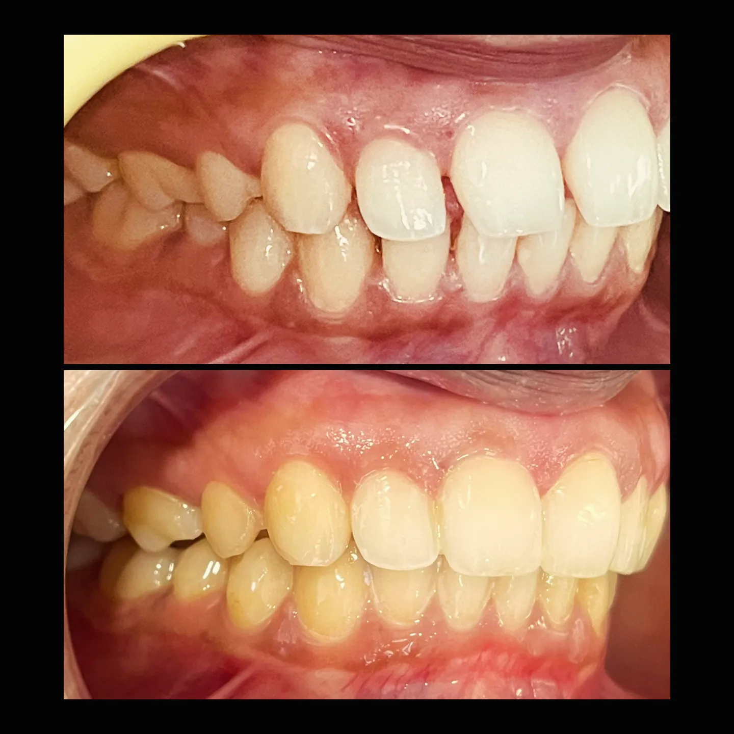 before-after1