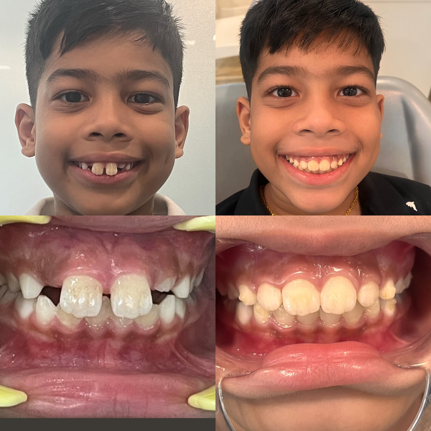 before-after2