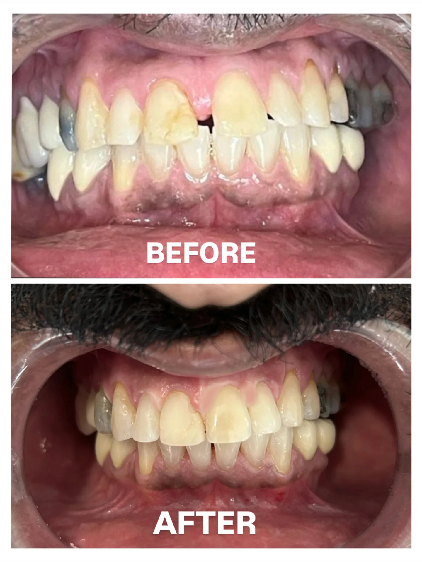 before-after5