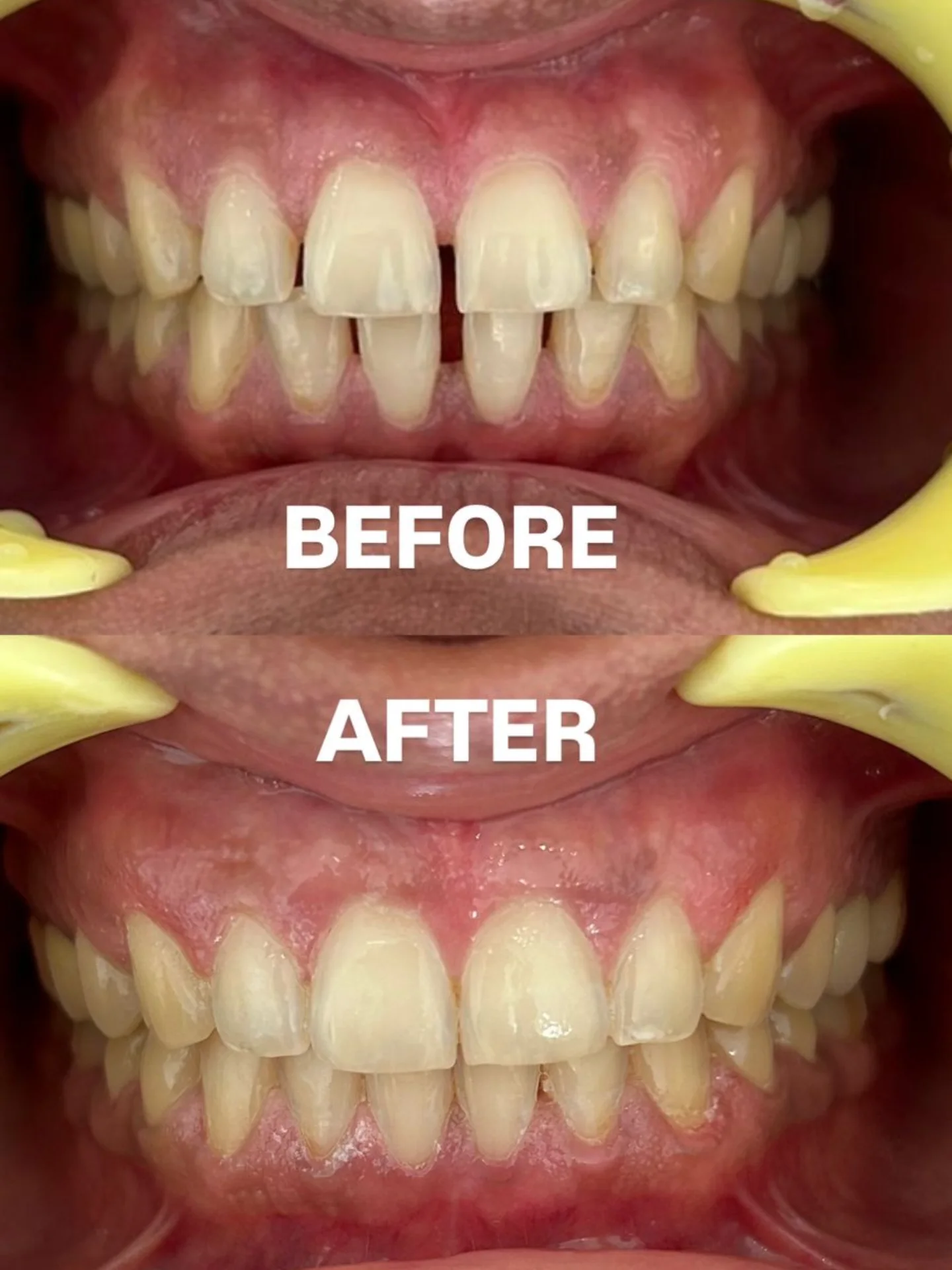 before-after6