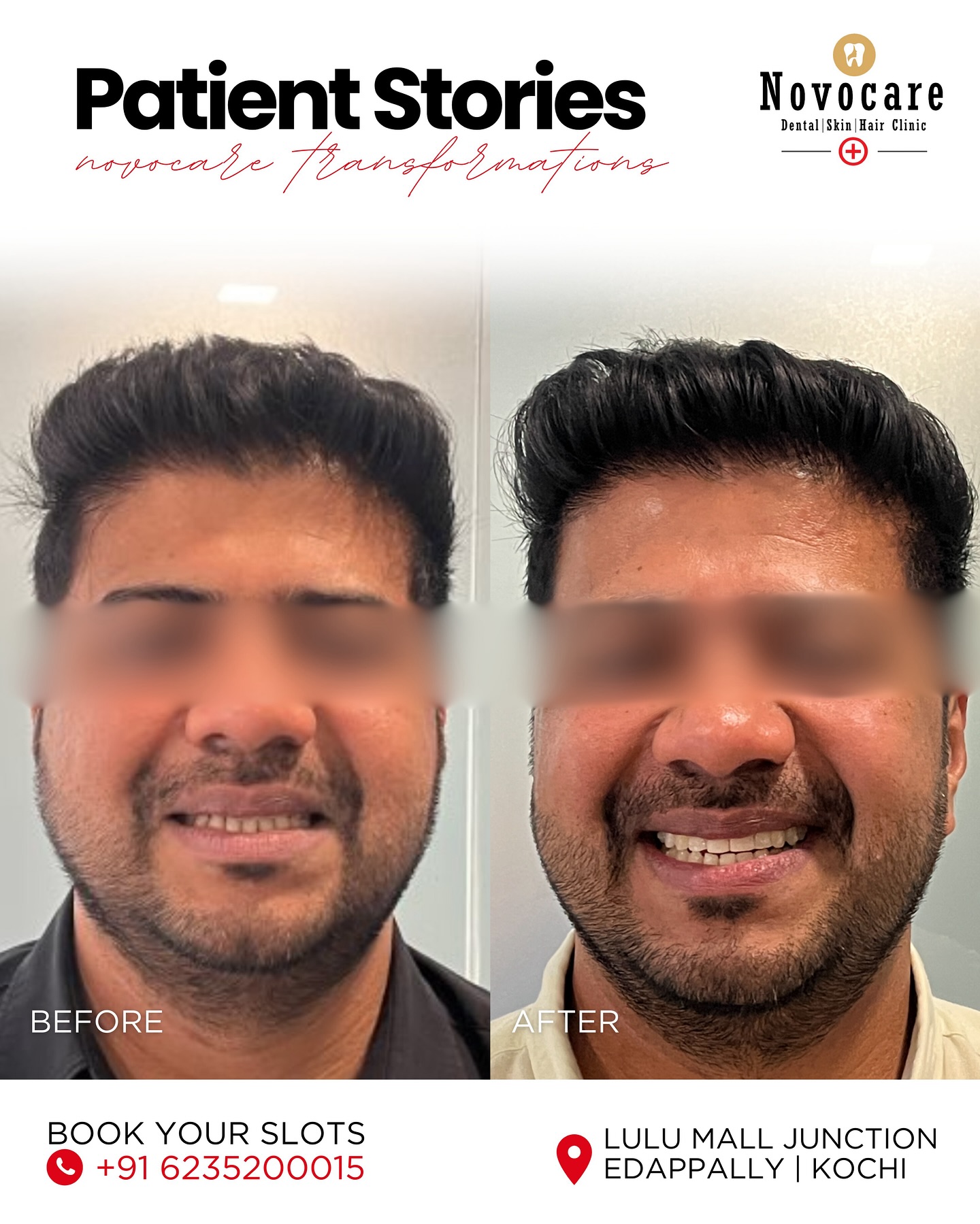 before-after8
